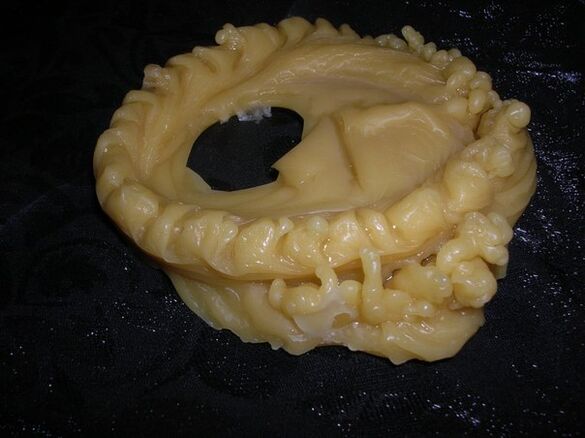 Zauberwachs
